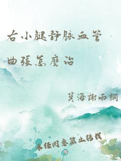 右小腿静脉血管曲张怎么治