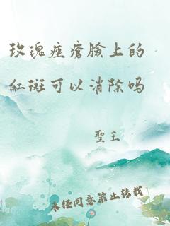 玫瑰痤疮脸上的红斑可以消除吗